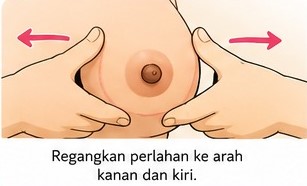 Langkah Mengompres Puting